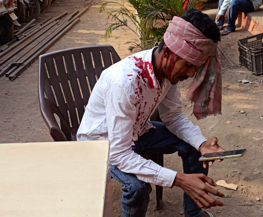 जमशेदपुर: पुलिस चेकिंग से बचने की कोशिश में युवक हुआ घायल, अस्पताल में भर्ती