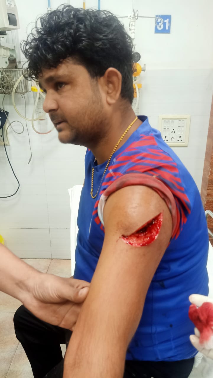 Jamshedpur : जुबली पार्क के पास लोन रिकवरी करने आए युवकों ने धारदार हथियार से किया हमला, एक धराया