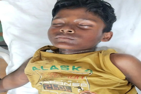 Jamshedpur : हरहरगुटू में पतंग उतारने ट्रांसफॉर्मर पर चढ़ा किशोर झुलसा, गंभीर