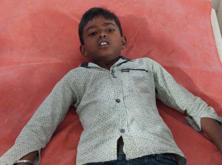 Gamharia: दुगनी के कोलढीपी में आठ वर्षीय बालक को सांप ने काटा