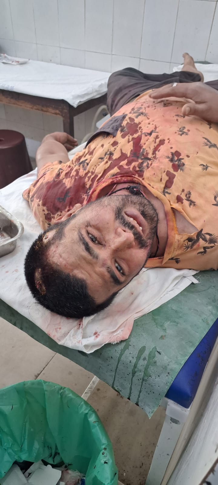 jamshedpur : साकची में दो दुकानदार आपस में भिड़े, जमकर हुई मारपीट