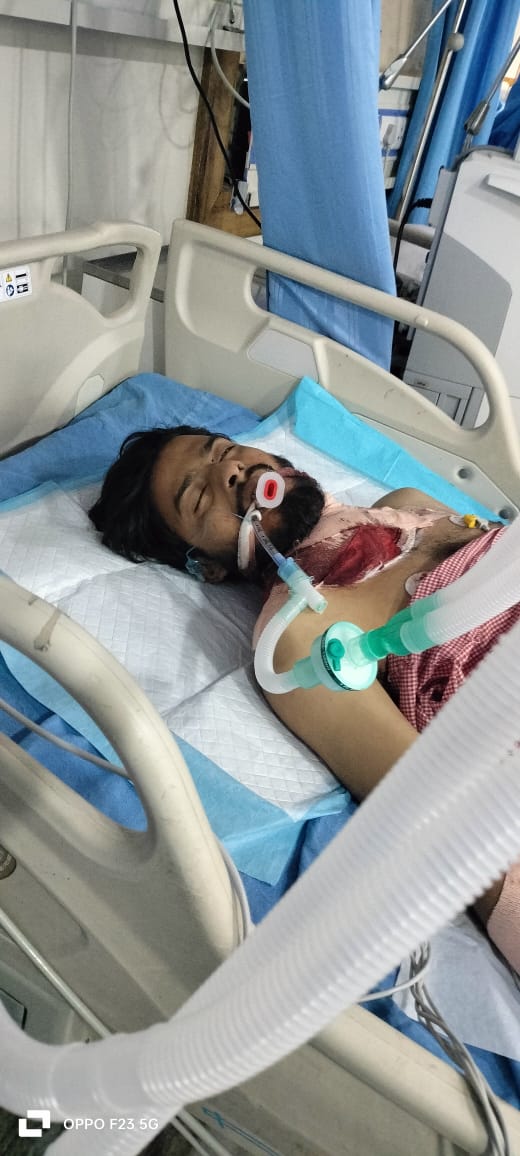 Jamshedpur : आजादनगर में कपाली के युवक पर धारदार हथियार से हमला, टीएमएच में भर्ती