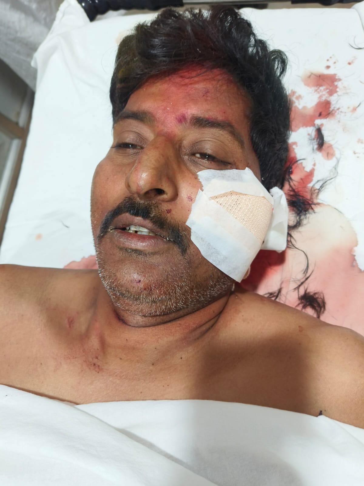 BREAKING NEWS: हरहरगुट्टु में घर में घुसकर मारी गोली, खुद चलकर टी एम एच पहुंचा घायल