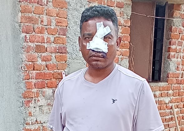 Saraikela: सरायकेला में जंगली भालू का आतंक, युवक पर किया हमला