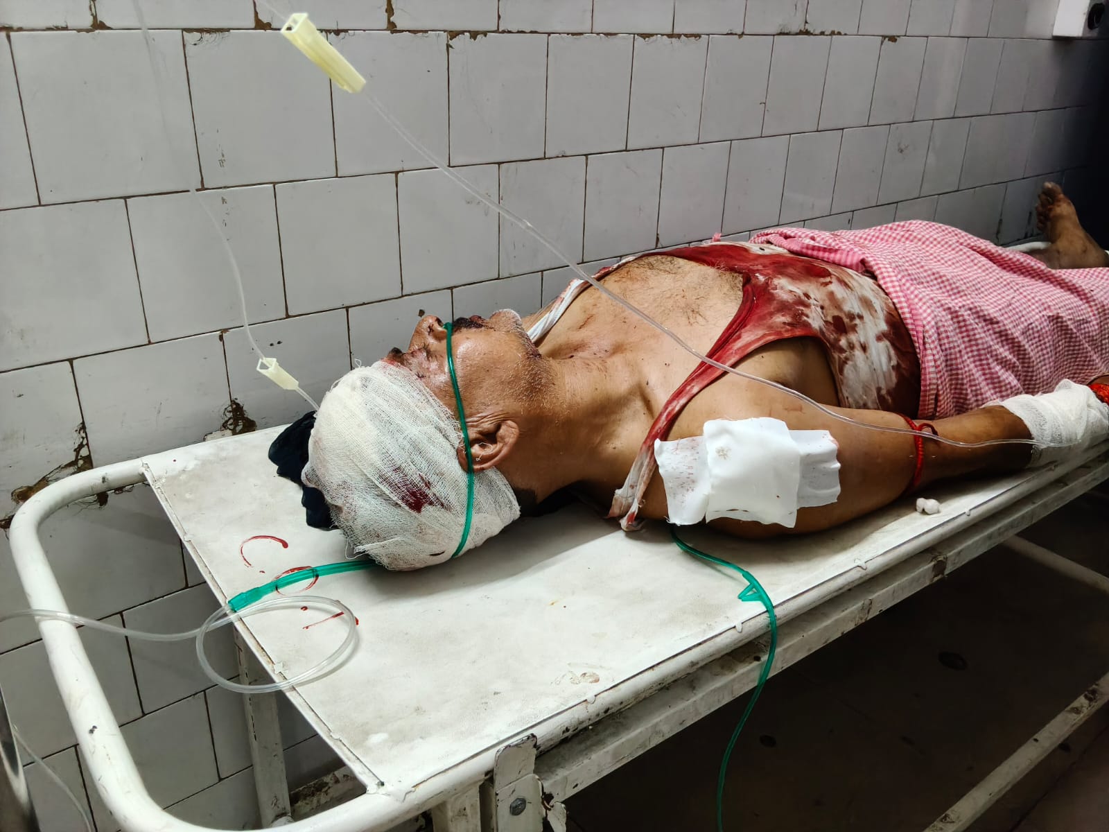 Jamshedpur Breaking: पारिवारिक विवाद के चलते बर्मामाइंस में हिंसक झड़प, छह लोग घायल