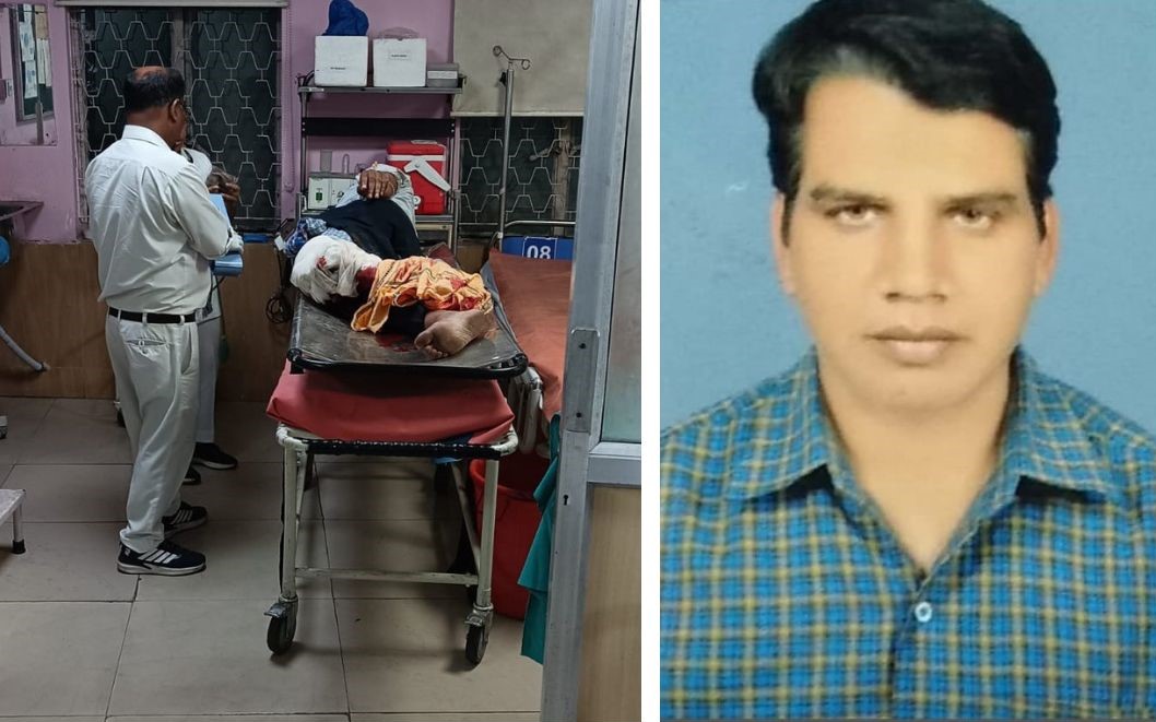 Jamshedpur: ऑपरेटिंग विभाग की लापरवाही से हादसे का शिकार बना लोको पायलट, चक्का चढ़ने से पैर जख्मी