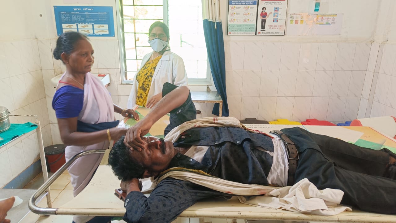 Baharagora: ट्रक की चपेट में आने से मोटरसाइकिल सवार घायल