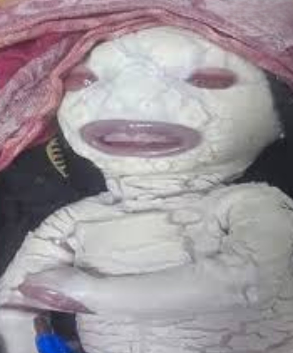 Madhya Pradesh: मध्यप्रदेश के रीवा में जन्मा ‘एलियन’ जैसा नवजात, डॉक्टर भी रह गए हैरान