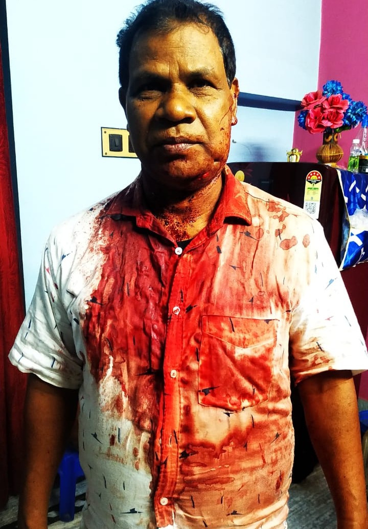 Jhargram: झाड़ग्राम में बंदरों का कहर, शिक्षक पर किया हमला – छात्र सहमे