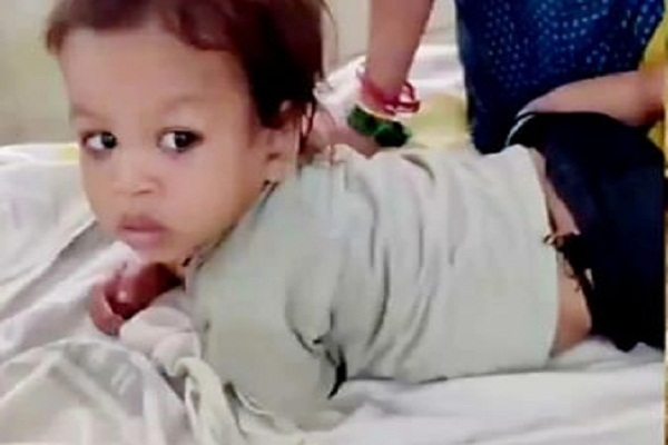 Bettiah : एक साल के बच्चे ने कोबरा को दांत से काटा, सांप की मौत