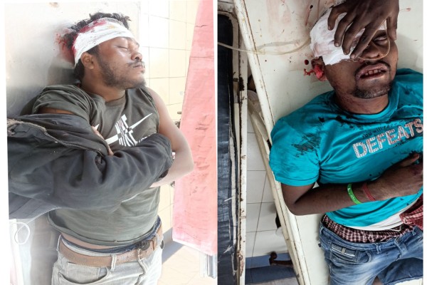 Bahragora: बहरागोड़ा में दो मोटरसाइकिलों की भीषण टक्कर, दो की हालत गंभीर – ओडिशा रेफर