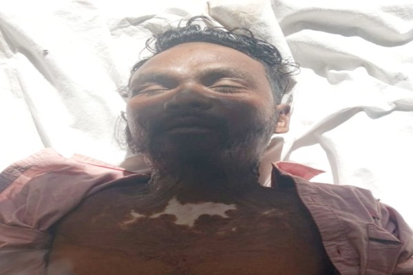 Adityapur: आदित्यपुर में पेंटर ने लगाई फांसी, पड़ोसियों से झगड़े के बाद उठाया कदम