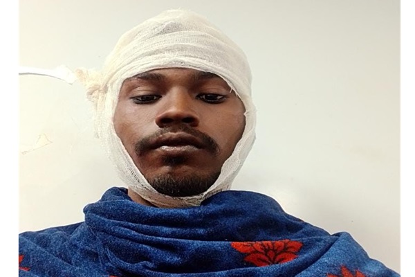 Jamshedpur : न्यू कपाली बस्ती में चापड़ से जानलेवा हमला, 19 वर्षीय युवक की हालत गंभीर