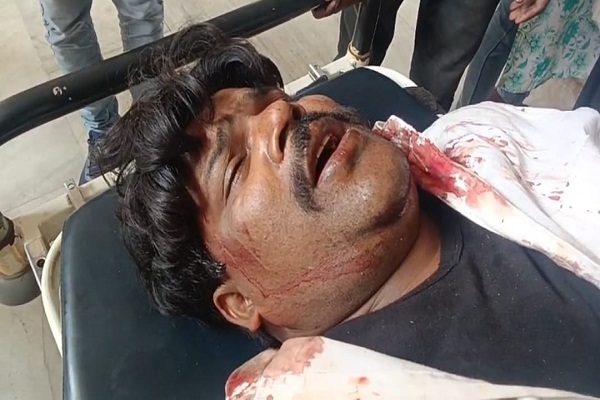 Jamshedpur : परसुडीह में शराब माफिया के गुर्गों ने दंपति पर हमला कर किया जख्मी, सदर अस्पताल में चल रहा है इलाज