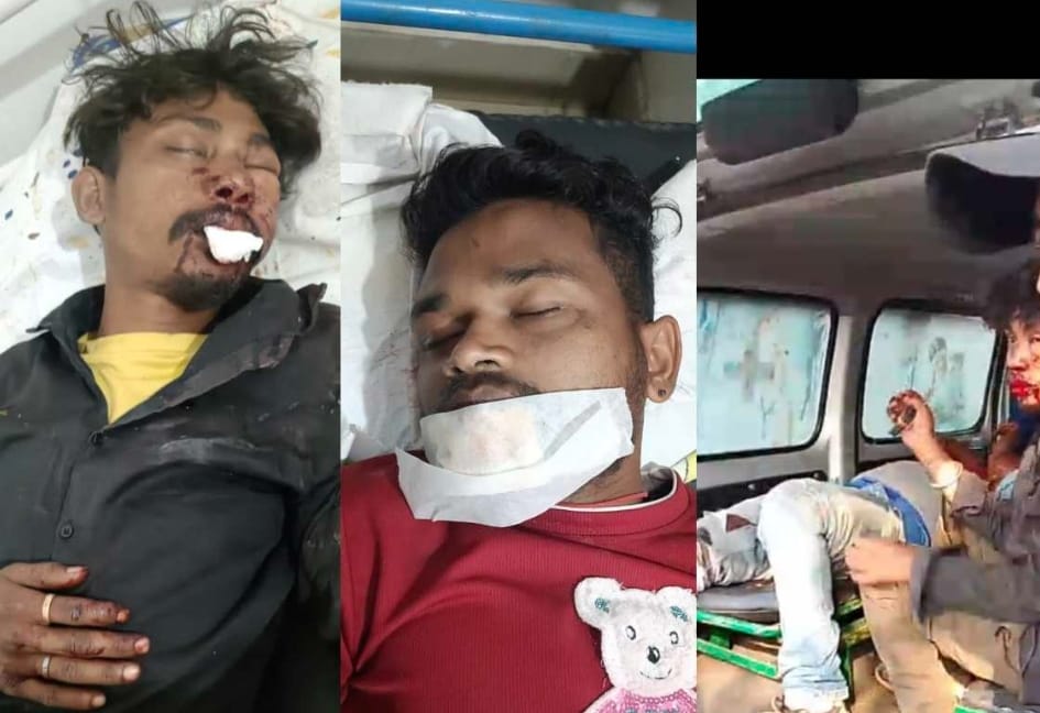 Patamada : कमलपुर में दो बाइक की सीधी भिड़ंत, तीन युवक गंभीर रूप से घायल, MGM अस्पताल रेफर