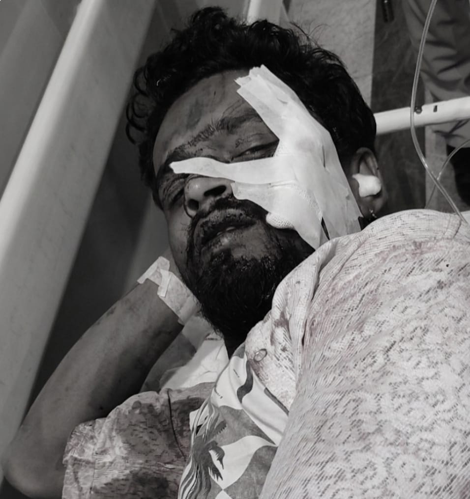 Jamshedpur : उलीडीह में जेल से 2 दिन पहले छूटे राजू सिंह ने दोस्त पर किया चाकू से हमला, शराब पीने के दौरान विवाद ने लिया हिंसक रूप