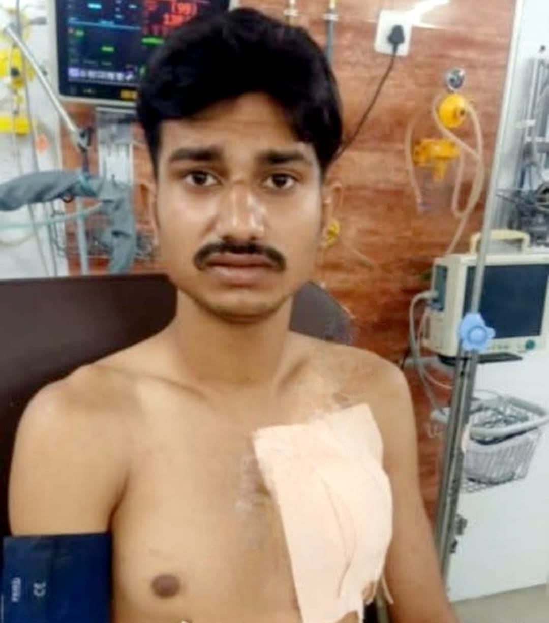 Jamshedpur : गोलमुरी में पारिवारिक विवाद में चाचा ने भतीजे को चाकू से मारकर किया घायल, टीएमएच में चल रहा है इलाज