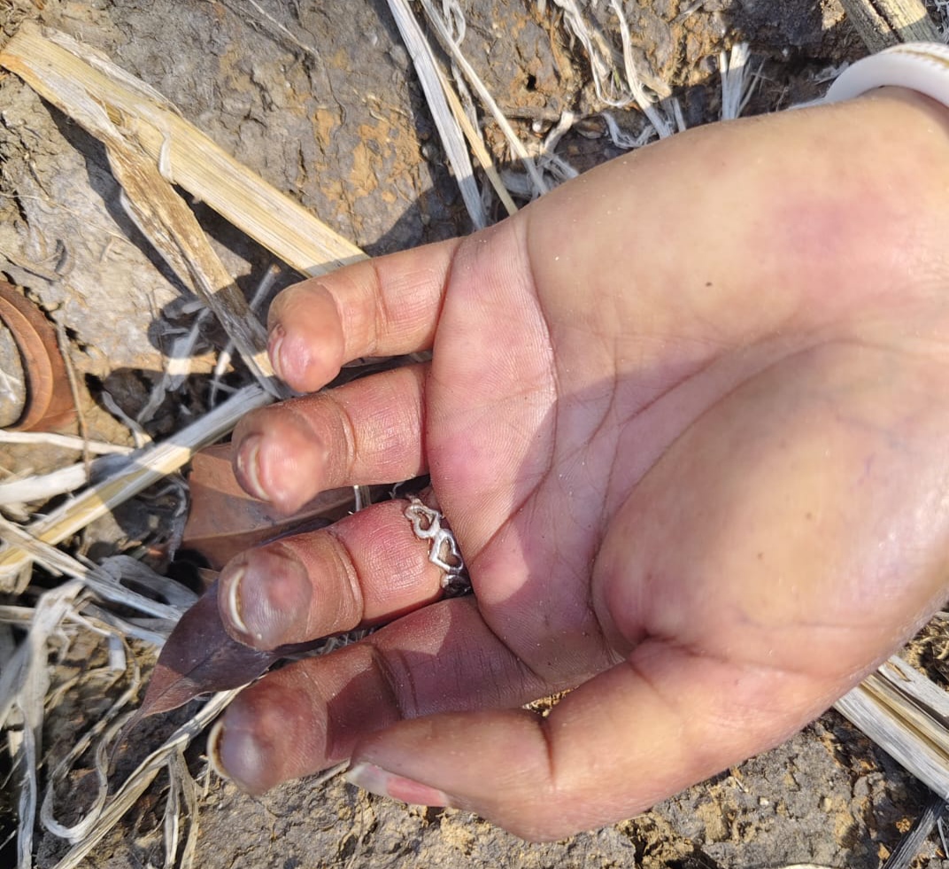 Jamshedpur : कीताडीह में शराब के नशे में युवक ने काटी गर्दन की नस, गंभीर हालत में MGMCH में कराया गया भर्ती 