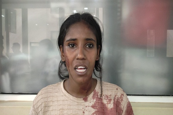 Jamshedpur : टेल्को में भैंस बांधने को लेकर हुए विवाद में दो पक्षों के बीच मारपीट, घायलों का MGMCH में चल रहा इलाज