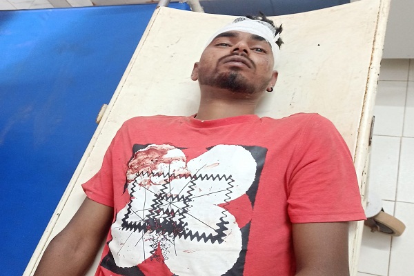 Bahragora : माटिहाना फ्लाईओव्हर पर डिवाइडर से टकराई बाइक, धनाडाही का युवक गंभीर रूप से घायल